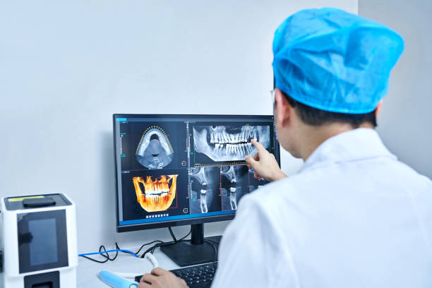 Best Knocked-Out Tooth (Avulsed Tooth) Treatment in Lakeside, FL